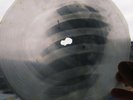 USSR GEORGIAN X-RAY ROENTGEN SKULL  RECORD  UNIQUE ITEM