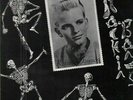 Ronnie Dawson Rockin Bones No Hit Records Vinyl LP