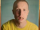 Injury Reserve - Dentist Office Series - Easter Yellow & Hot Pink Vinyl - 2 LP