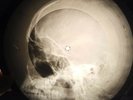 Doors - People are Strange X-RAY BONE OF THE USSR X-RAY RECORDING