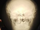 Who - Happy Jack X-RAY BONE OF THE USSR X-RAY RECORDING