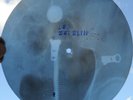 LED ZEPPELIN - LIVIN, LOVIN, MAID - USSR GEORGIAN UNIQUE X-RAY BONES RECORD