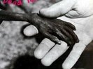 Dead Kennedys - Plastic Surgery Disasters - LP Vinyl - New
