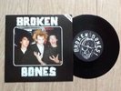 BROKEN BONES .. SEEING THROUGH MY EYES 7
