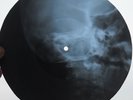 ROLLING STONES - PAINT IT BLACK -USSR GEORGIAN X-RAY ROENTGEN SKULL BONES RECORD