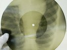 X-Ray Audio roentgen film Record Bones Ribs 1950s 