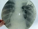 X-RAY 78rpm 9