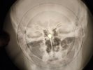 Beatles - Back In The U.S.S.R. X-RAY BONE OF THE USSR X-RAY RECORDING SKULL