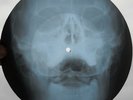 JOHNNY CASH & JUNE CARTER - JACKSON - USSR GEORGIAN X-RAY ROENTGEN SKULL RECORD