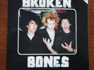 BROKEN BONES -SEEING THROUGH MY EYES -7
