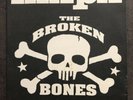 MxPx The Broken Bones 7” Vinyl Record 2000 Ride To Live (Rare)