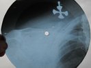 QUEEN - MODERN TIMES ROCK N ROLL - USSR GEORGIAN X-RAY ROENTGEN BONES RECORD