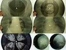 X-RAY 7x 78rpm SOKOLSKIS WERTINSKY & Deep Purple USSR ROENTGEN BONES Ribs Skulls