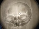 Rolling Stones - As Tears Go By  X-RAY SKULL USSR BONE RECORDING X-RAY