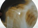 BOB DYLAN - BLOWING IN THE WIND - USSR GEORGIAN X-RAY ROENTGEN BONES RECORD