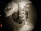 Doors - Strange Days  X-RAY USSR X-RAY BONE RECORDING