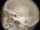 Doors - Spanish Caravan X-RAY USSR BONE RECORD X-RAY