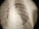 Benny Goodman - Let's Dance X-RAY USSR BONE RECORDING