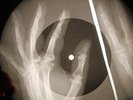 Beatles - Baby It's You X-RAY OF THE USSR  X-RAY RECORD BONES