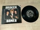 BROKEN BONES - SEEING THROUGH MY EYES 7