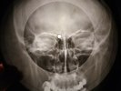 Elvis Presley - Lawdy, Miss Clawdy X-RAY OF THE USSR BONE RECORD