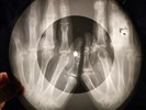 Elvis Presley - Comon Everybody X-RAY OF USSR  X-RAY BONES RECORD