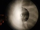 Bee Gees - Stayin Alive X-RAY OF THE USSR X-RAY BONE RECORDING