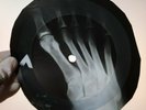 TREMELOES SUDDENLY YOU LOVE ME X-Ray USSR Record Roentgen Bones Ribs Music Vinyl