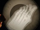 Beatles - She Loves You X-RAY OF USSR X-RAY RECORDING THE BONES