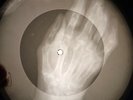Beatles - Please Please Me X-RAY OF THE USSR X-RAY BONES RECORDING