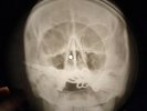 Rolling Stones - Jumping Jack Flash X-RAY OF THE USSR RECORDING BONES