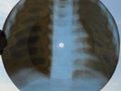 THE ANIMALS - ROBERTA - USSR GEORGIAN X-RAY ROENTGEN BONES RECORD