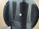 JOHNNY CASH RING OF FIRE X-Ray USSR Record Roentgen Bones Ribs Music Vinyl