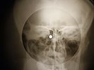 Rolling Stones - Paint It Black X-RAY OF THE USSR X-RAY BONE RECORD