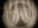 Doors - Hello, I Love You X-RAY OF THE USSR X-RAY BONE RECORDING