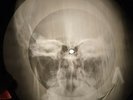 Doors - Unhappy Girl X-RAY OF USSR X-RAY RECORDING THE BONE