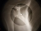 Doors - Hyacinth House X-RAY OF THE USSR X-RAY BONE RECORD
