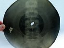 X-RAY 78rpm 9