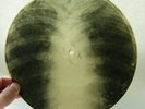 X-RAY 78rpm 9