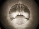 Alice Cooper - Under My Wheels X-RAY OF USSR X-RAY BONES RECORD