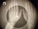 Kinks - All Day And All Of The Night X-RAY OF USSR X-RAY BONES RECORD