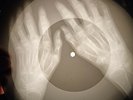 Beatles - I'm Looking Through You X-RAY OF USSR X-RAY BONES RECORD