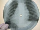 BLACK SABBATH PARANOID X-Ray USSR Record Roentgen Bones Ribs Music Vinyl