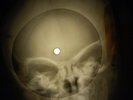 Beatles - Back In The U.S.S.R. X-RAY OF THE USSR X-RAY BONE RECORDING