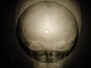 Beatles - Please, Please Me X-RAY OF THE USSR X-RAY BONES RECORDING