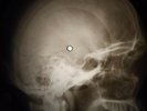 Beatles - Act Naturally X-RAY OF THE USSR X-RAY BONES RECORDING