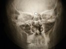 Beatles - Sea Of Holes X-RAY OF USSR X-RAY BONES RECORDING