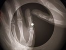 Roy Orbison - In Dreams X-RAY OF THE USSR X-RAY BONE RECORD