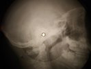 Doors - Break On Through X-RAY OF THE USSR X-RAY BONE RECORDING