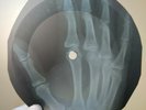 ROLLING STONES I AM WAITING X-Ray USSR Record Roentgen Bones Ribs Music Vinyl